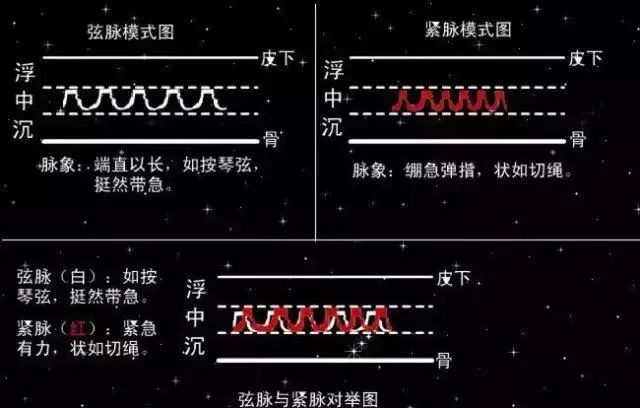 脉象模式对比图二