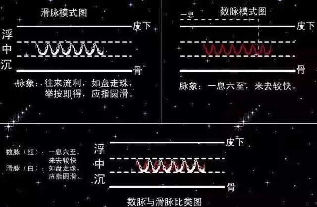 脉象模式对比图三