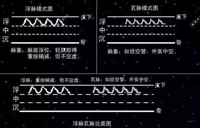 脉象模式对比图五